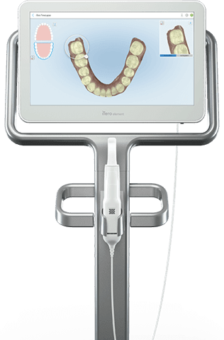 Itero Scanner - MyOrthodontist